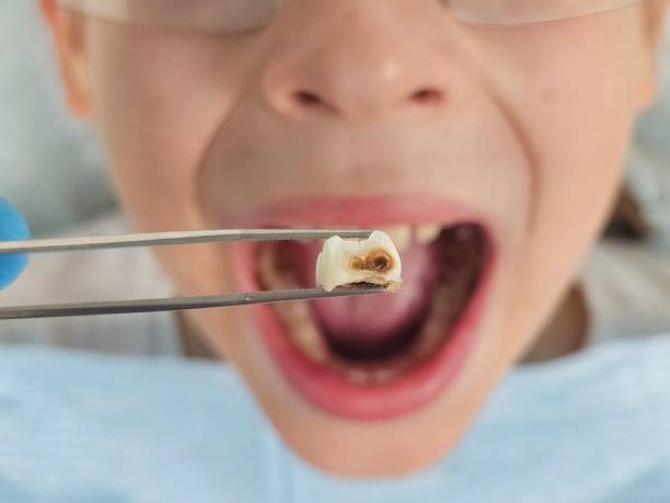 Best Dentist for Tooth Abscess  in Hazel Crest, IL