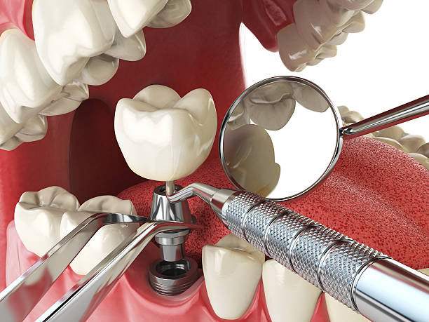 Best Urgent Tooth Repair  in Hazel Crest, IL